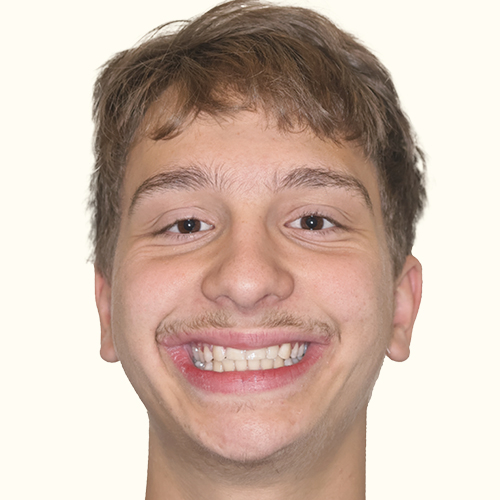 Erfahrungsbericht bei Dr. Stefan Brünner - Zahnarzt und Kieferorthopädie in Bruck