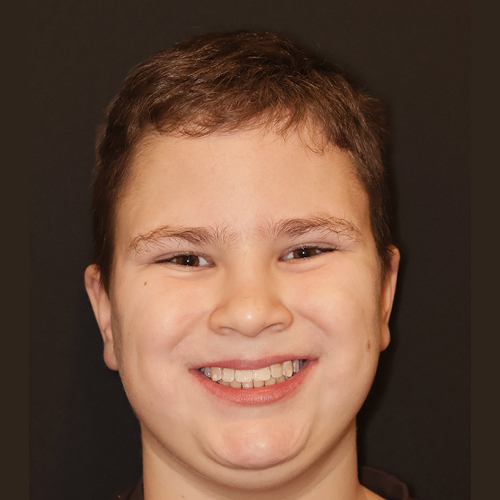 Erfahrungsbericht bei Dr. Stefan Brünner - Zahnarzt und Kieferorthopädie in Bruck