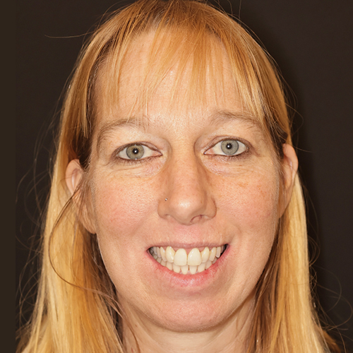 Erfahrungsbericht bei Dr. Stefan Brünner - Zahnarzt und Kieferorthopädie in Bruck