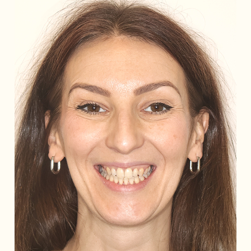 Erfahrungsbericht bei Dr. Stefan Brünner - Zahnarzt und Kieferorthopädie in Bruck