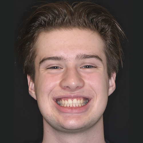 Erfahrungsbericht bei Dr. Stefan Brünner - Zahnarzt und Kieferorthopädie in Bruck